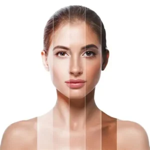 نوع پوستت چیه؟ | راهنمای کامل تشخیص و مراقبت از انواع پوست