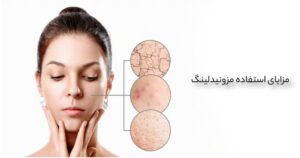 مزونیدلینگ چیست؟ | راهنمای کامل، مزایا و مراقبت‌های پس از درمان