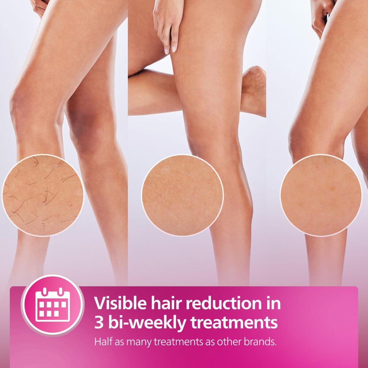 سری 4.1 cm² بزرگ لیزر فیلیپس BRI940 برای درمان سریع پاها و نواحی وسیع